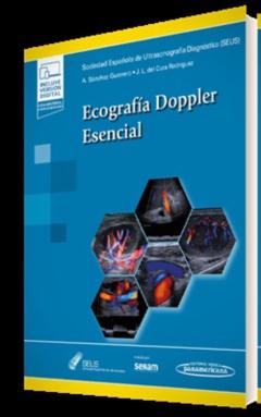 Ecografía Doppler Esencial