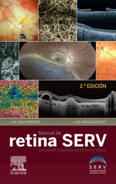 Manual De Retina Serv, 2ª Ed.