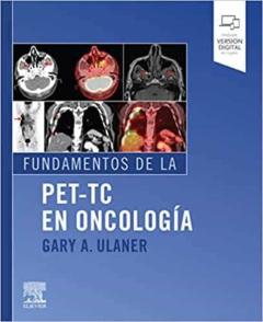 Fundamentos De La Pet-Tc En Oncologia