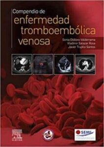 Compendio De Enfermedad Tromboembolica Venosa