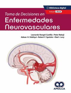 Toma De Decisiones En Enfermedades Neurovasculares