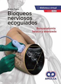 Libro, Audiolibro Bloqueos Nerviosos Ecoguiados. Sonoanatomía Básica Y Avanzada Bloqueos Nerviosos Ecoguiados. Sonoanatomía Básica Y Avanzada