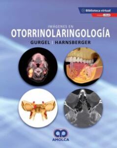 Imágenes En Otorrinolaringología + E-Book