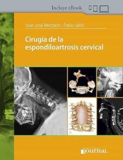 Cirugia De La Espondiloartrosis Cervical (Incluye E-Book)