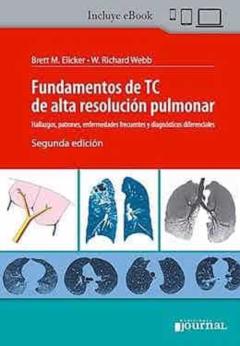 Fundamentos De Tc De Alta Resolucion Pulmonar (2ª Ed.)