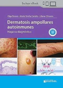 Dermatosis Ampollares Autoinmunes (Incluye Ebook)