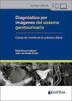Diagnostico Por Imagenes Del Sistema Genitourinario (Incluye Ebook)