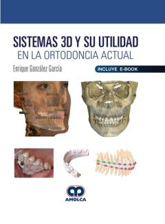 Sistemas 3D Y Su Utilidad En La Ortodoncia Actual (Incluye Ebook)
