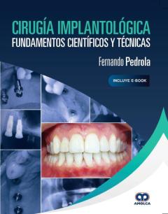 Cirugía Implantológica. Fundamentos Científicos Y Técnicas (Incluye E-Book)