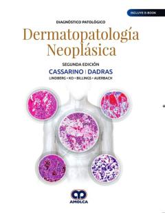 Diagnóstico Patológico. Dermatopatología Neoplásica (Incluye E-Bo Ok) (2ª Ed.)