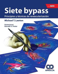 Siete Bypass: Principios Y Tecnicas De Revascularizacion + E-Book